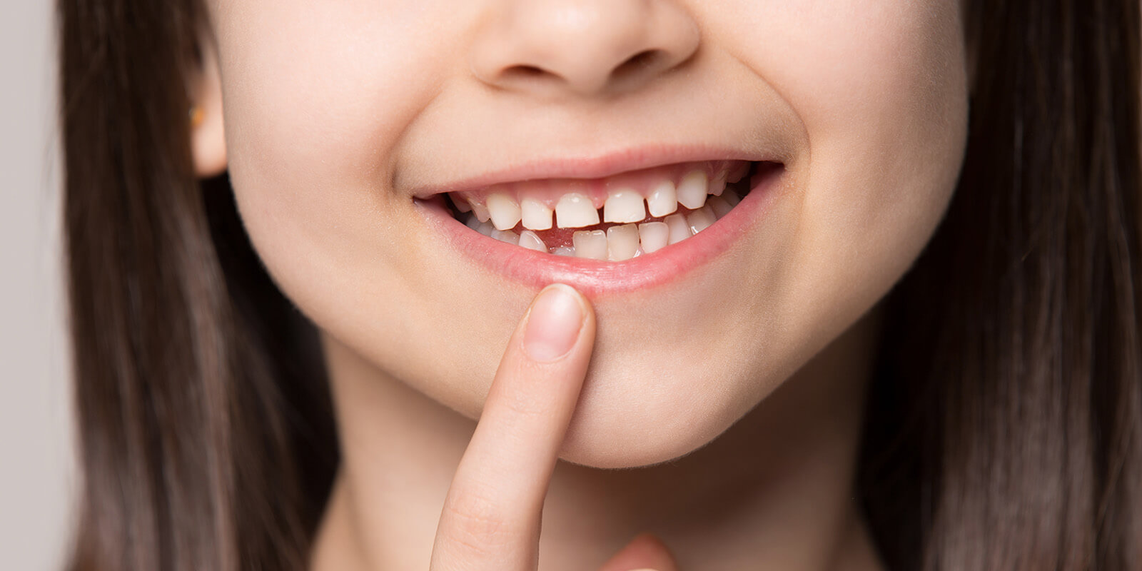 お子さんを虫歯から守るための診療メニュー