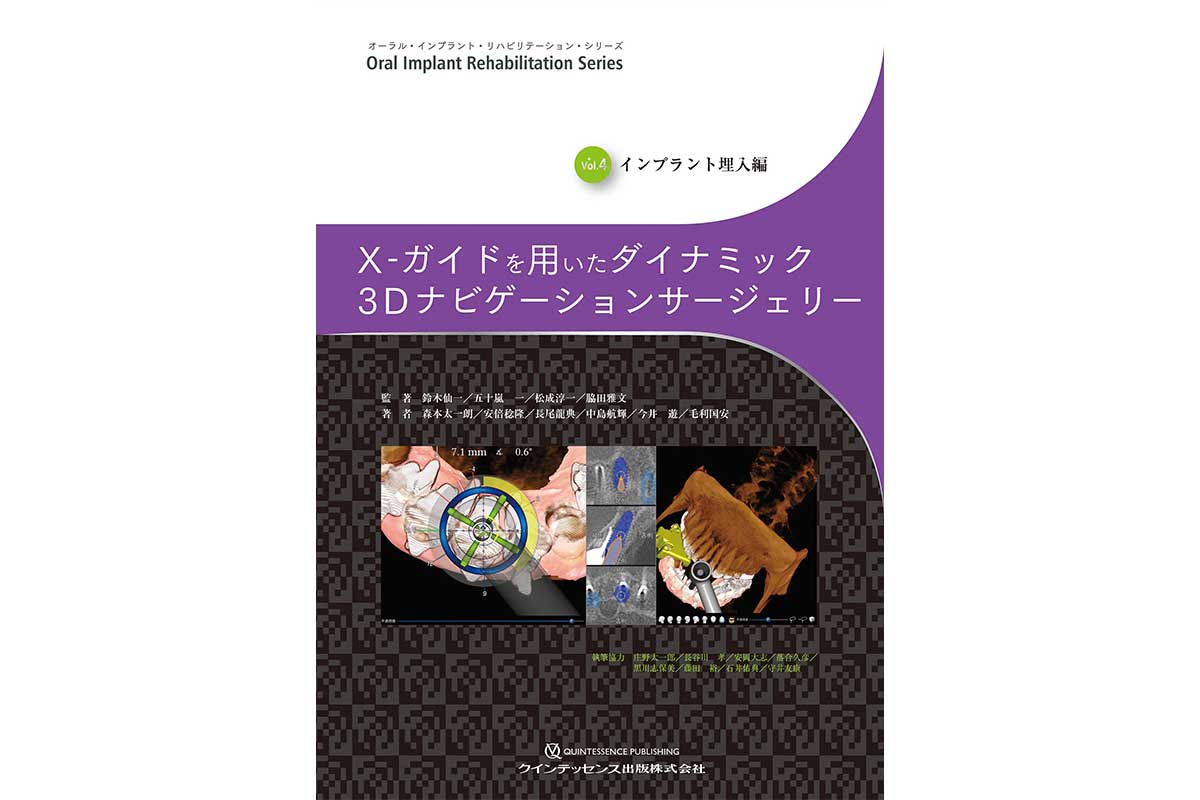 オーラル・インプラント・リハビリテーション・シリーズ Vol.4 インプラント埋入編 X-ガイドを用いたダイナミック3Dナビゲーションサージェリー