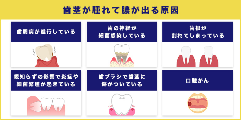 歯茎が腫れて膿が出ている時に考えられる原因7選と切開が必要なケース - デンタルオフィス大阪梅田