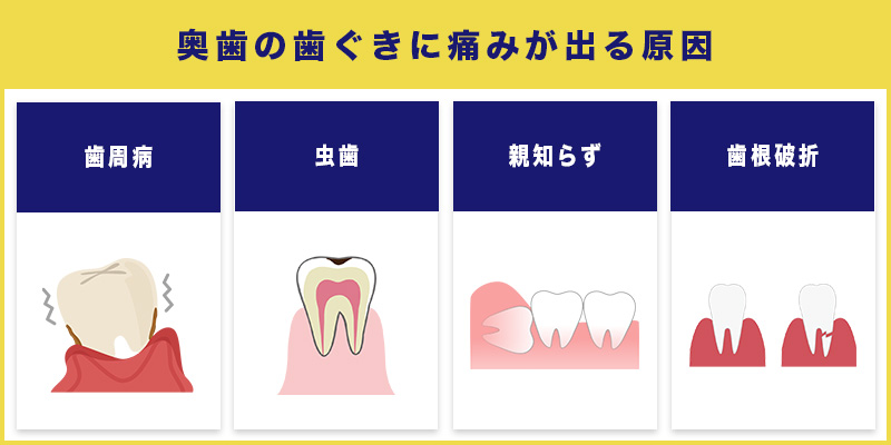 奥歯の歯ぐきに痛みが出る原因
