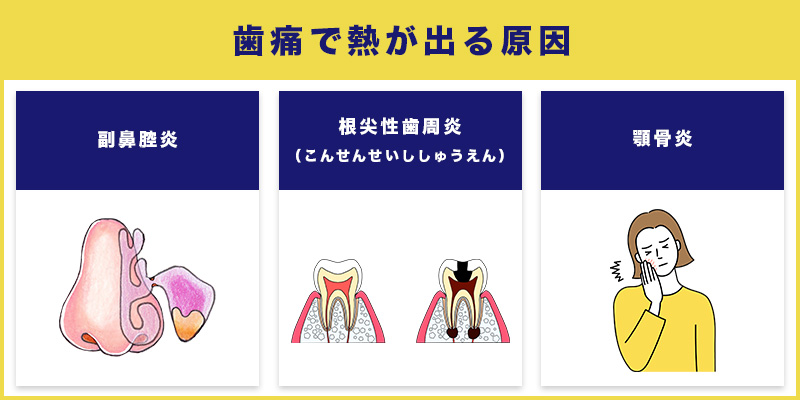 歯痛で熱が出る原因