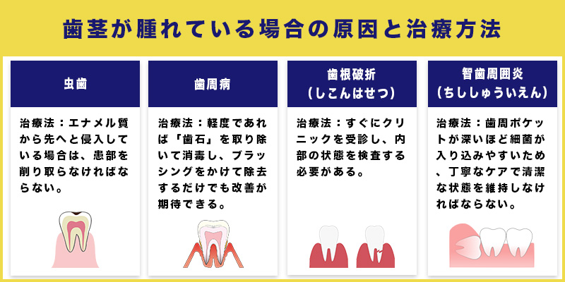 歯茎が腫れている場合の原因と治療方法