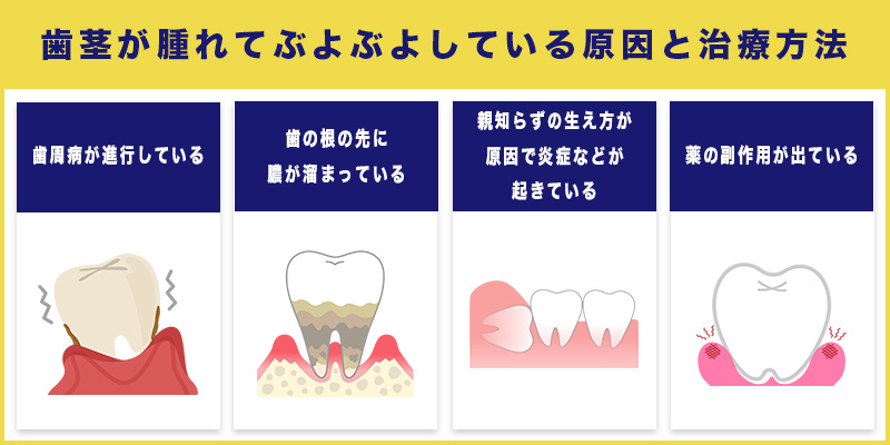 歯茎が腫れてぶよぶよしている原因と治療方法