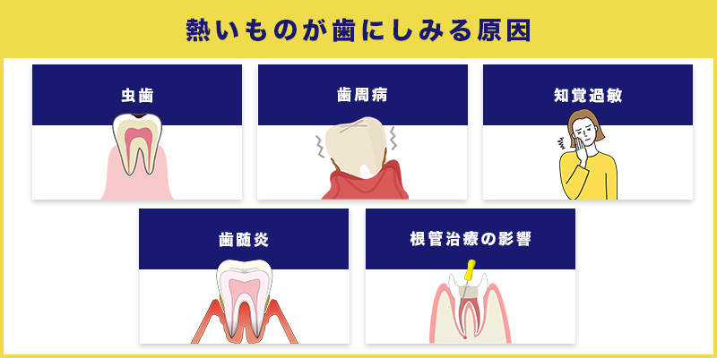 熱いものが歯にしみる原因