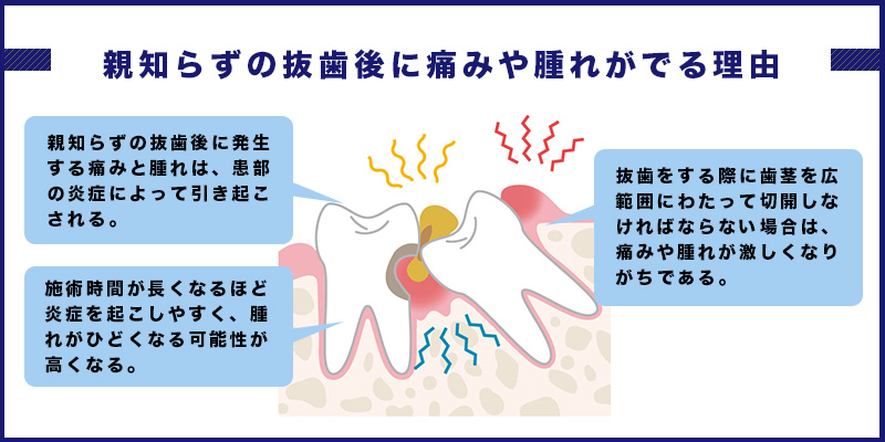 親知らずの抜歯後に痛みや腫れがでる理由