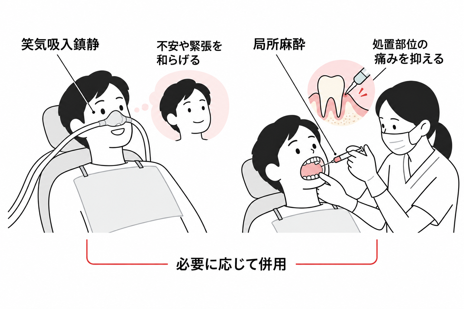 笑気麻酔とは？効果・副作用・注意点を解説 - デンタルオフィス大阪梅田